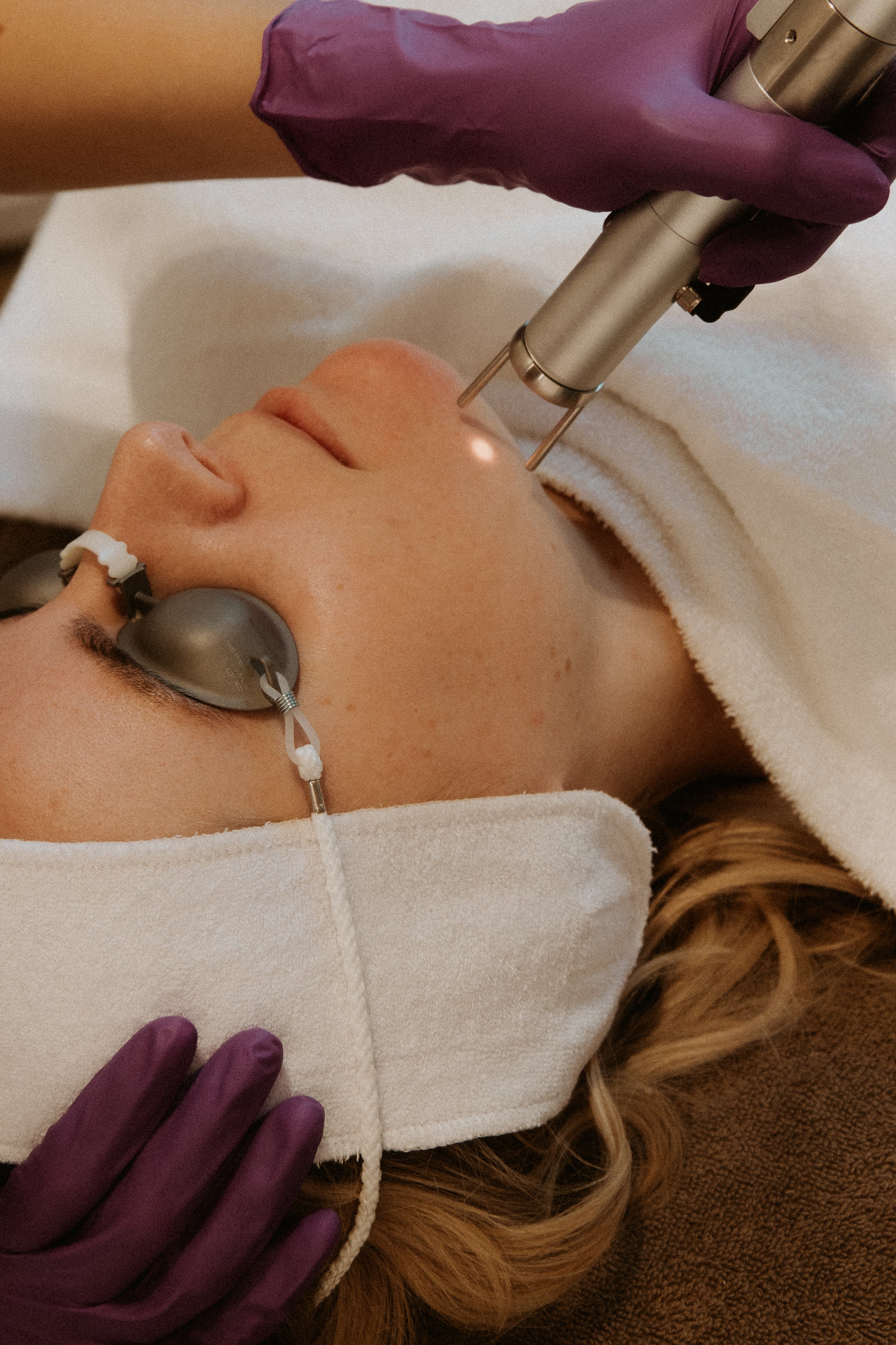 Er vindt een Laser Facial plaats waarbij een skin expert het laser apparaat over de klant haar gezicht heen beweegt 