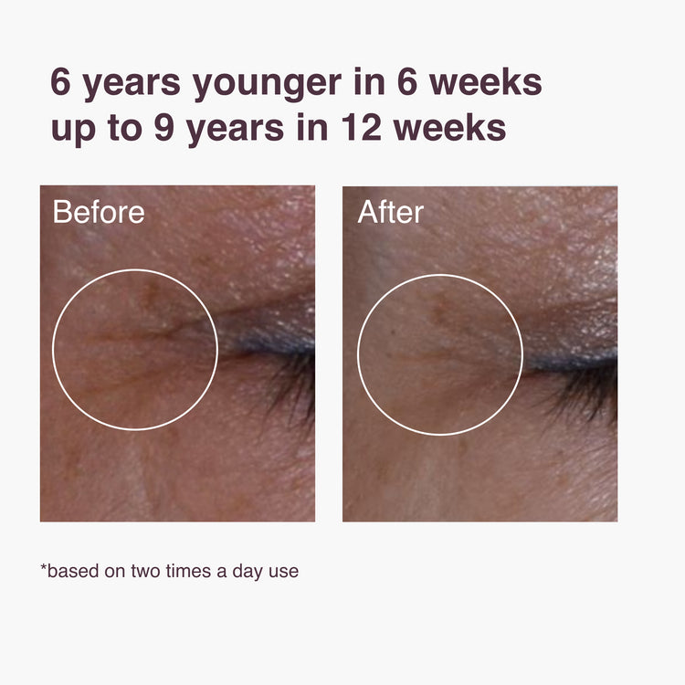 Zombie Cell Serum: resultaat na 6 weken gebruik