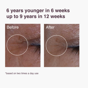 Zombie Cell Serum: resultaat na 6 weken gebruik