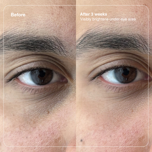 Vitamin K Eye Cream - 15ml