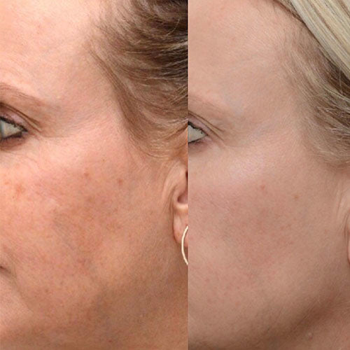 Wrinkles/Aged Skin - Skin Concern Package